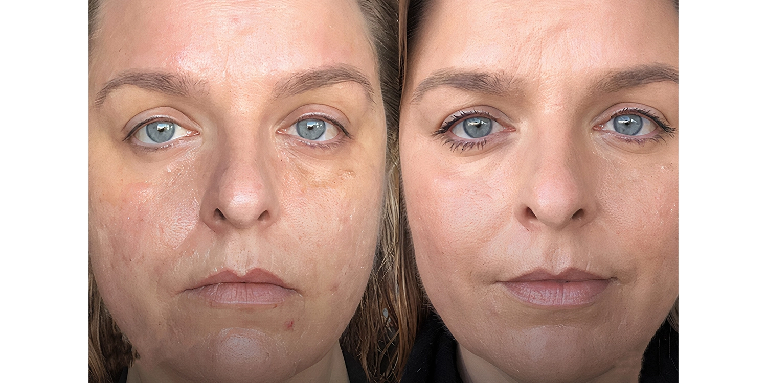 کوکتل مزوتراپی جوانساز