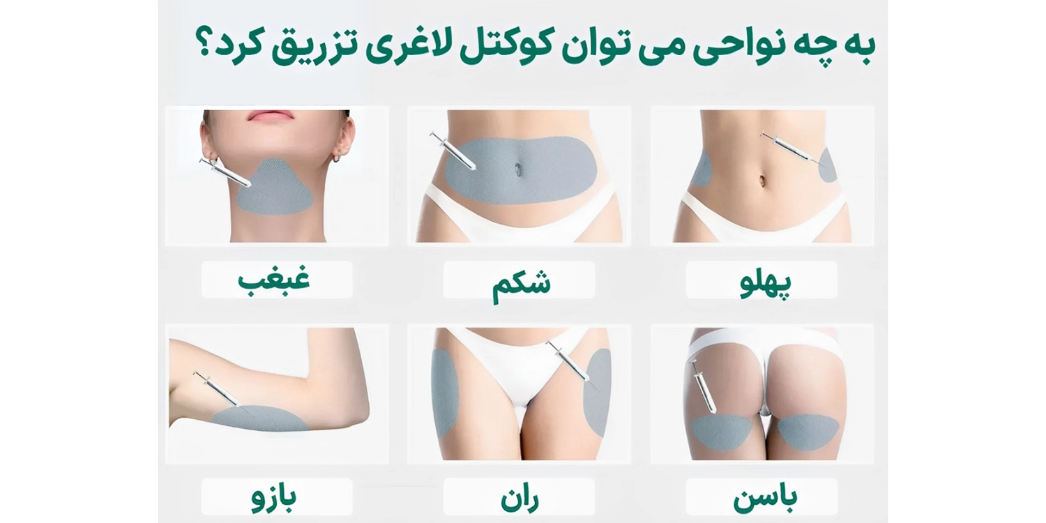 کوکتل مزوتراپی چربی سوز
