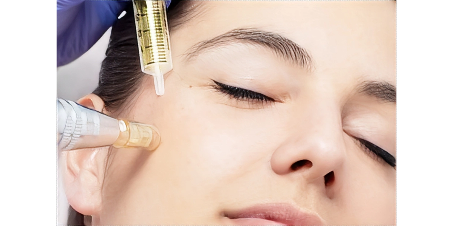 کوکتل مزو فیوژن