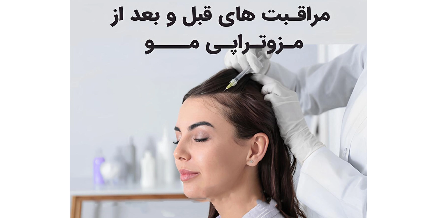 مراقبت‌های قبل و بعد از تزریق مزوتراپی BCN