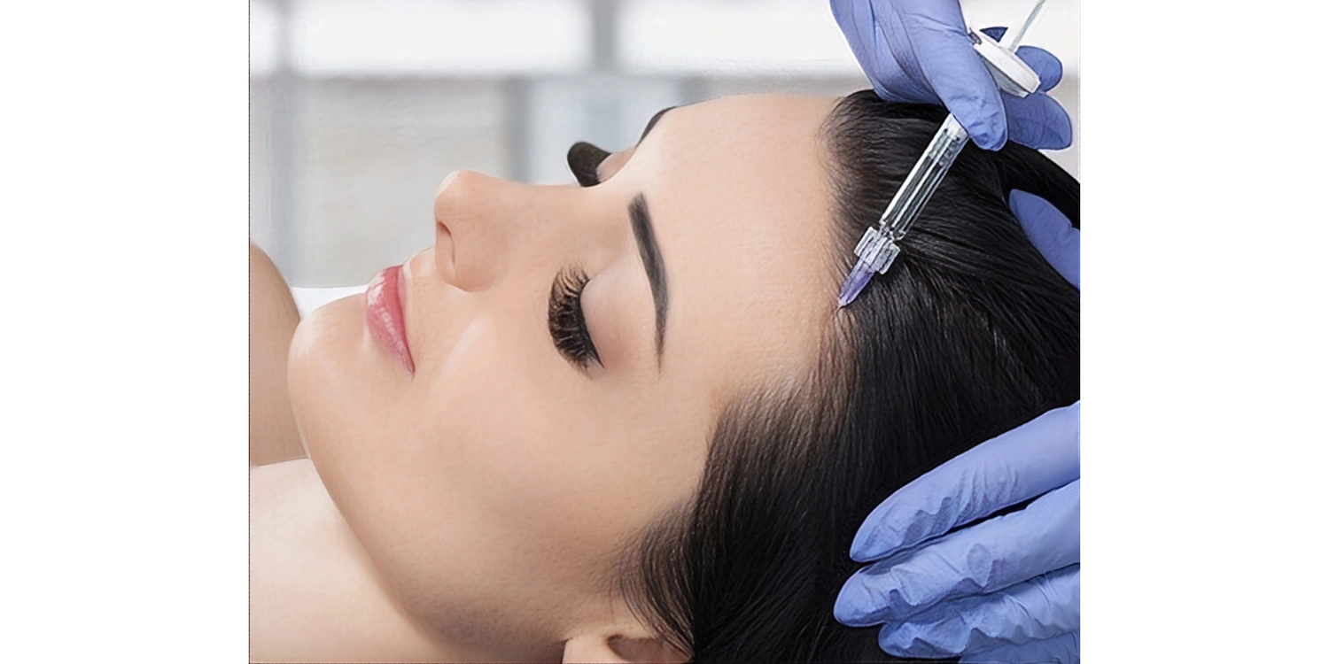 مراحل درمان مزوتراپی با کوکتل های بی سی ان : از شروع تا پایان